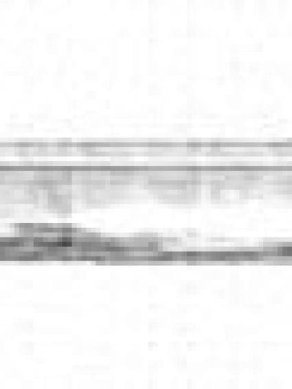 MA1235102 Hood Molding